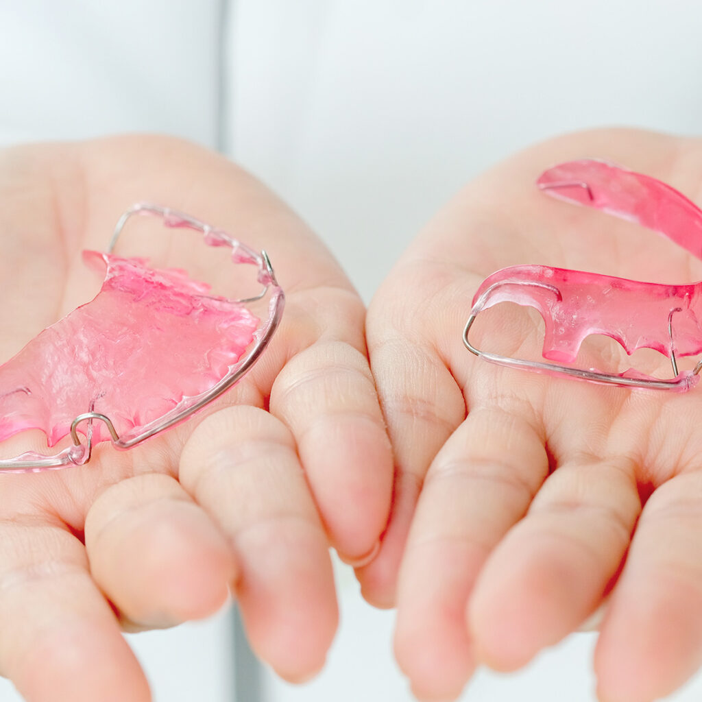 dental-retainers