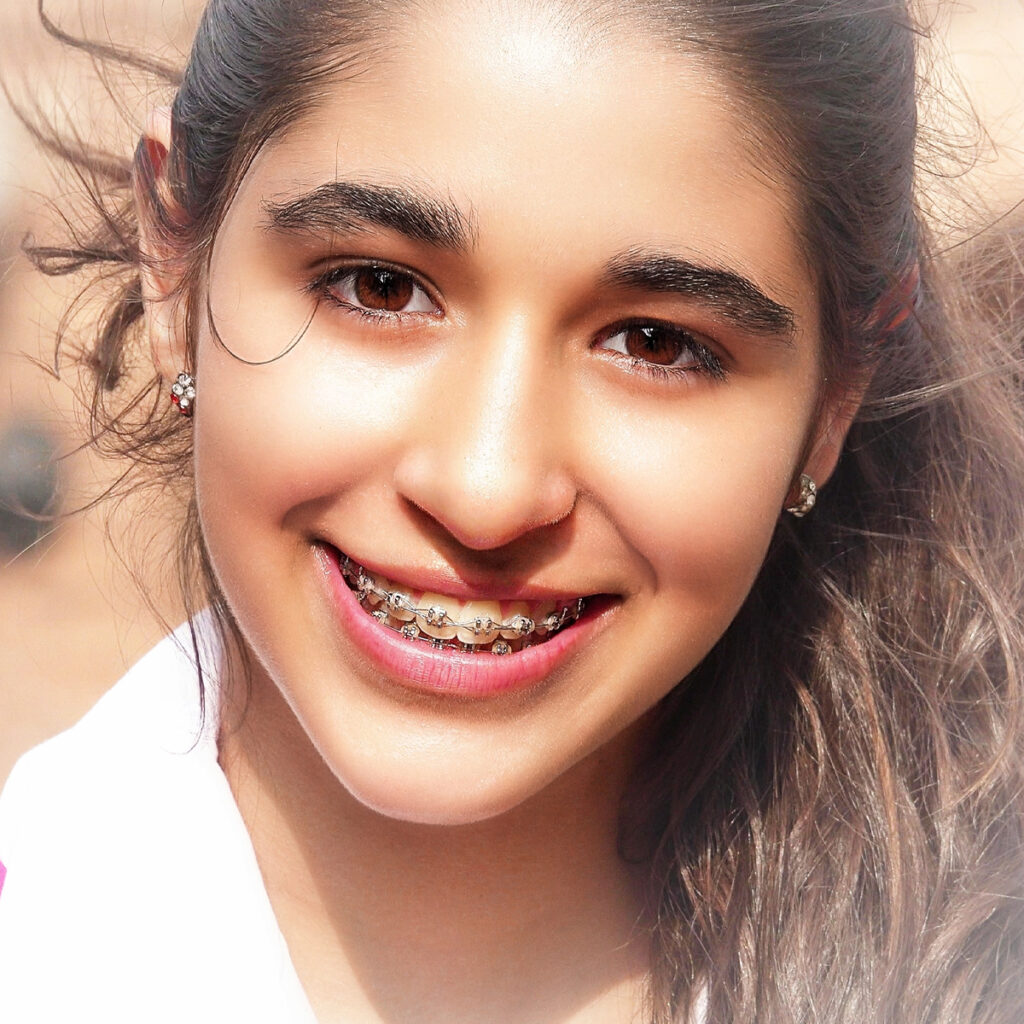 teen-dental-braces