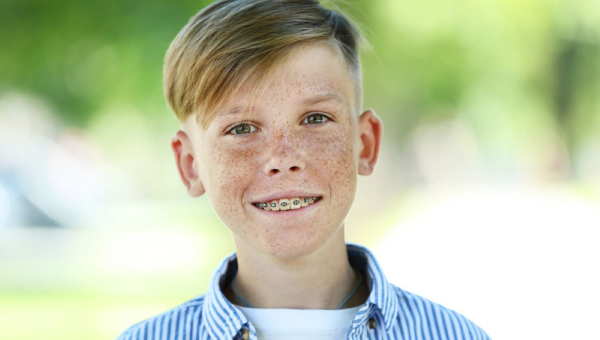 when-to-begin-league-city-dental-braces_thumbnail
