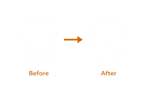 Common-Causes-of-TMD-and-Bruxism-removebg-preview-1